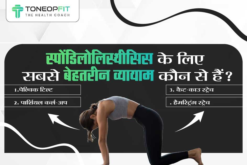 स्पोंडिलोलिस्थीसिस के लिए सबसे बेहतरीन व्यायाम कौन से हैं